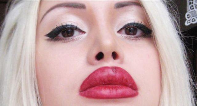 Chirurgie esthétique (FAIL) Chirurgie esthétique (FAIL)