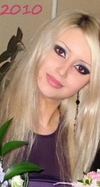 Chirurgie esthétique (FAIL) Chirurgie esthétique (FAIL)