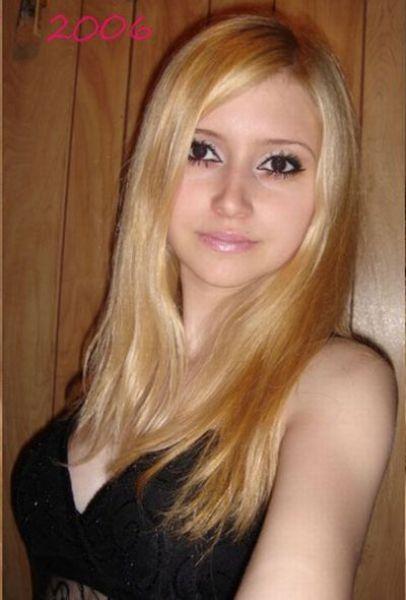 Chirurgie esthétique (FAIL) Chirurgie esthétique (FAIL)