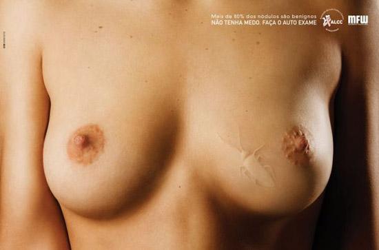 Association de lutte contre le cancer du sein