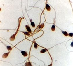Moins de spermatozoîdes? c'est la faute à Nutella!