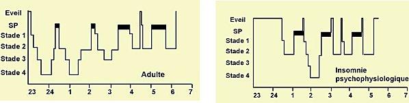 Les troubles du sommeil test.jpg