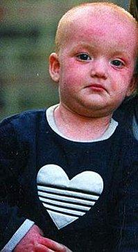 Elle fabrique une crème pour soigner sa fille et fait fortune lulaa3ans.jpg