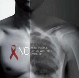 VIH-TB : VIVRE avec le VIH et mourir de la tuberculose, c’est évitable  – ONUSIDA