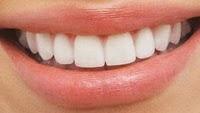 Remèdes de grand-mère pour blanchir les dents