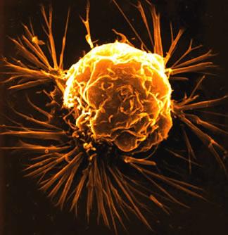 Cellule cancéreuse