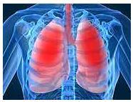 ASTHME: Pilule ou inhalateur, quel est le meilleur? – New England Journal of Medicine