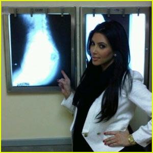 Kim Kardashian Gets Butt X-Ray