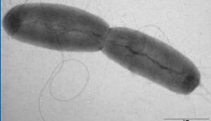 E. coli: Premier décès, à Bordeaux, d’une femme de 78 ans – ARS et InVS