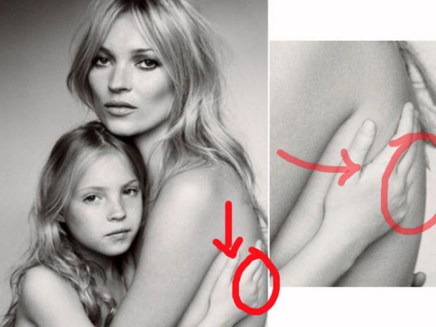 La fille de Kate Moss sans phalanges grace à Photoshop