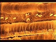 Le Modèle Neurophysiologique de Jastreboff - Neuro-Anatomie cellules cilliées, organe de corti, microscope électronique