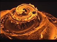 Le Modèle Neurophysiologique de Jastreboff - Neuro-Anatomie système nerveux auditif, cochlée, audition, organe