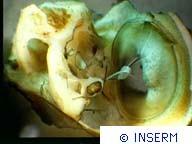 Le Modèle Neurophysiologique de Jastreboff - Neuro-Anatomie cochlée, oreille moyenne, cobaye, inserm