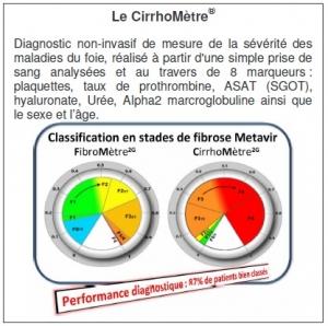 CIRRHOSE : Un CirrhoMètre® pour la diagnostiquer!  – CHU d’Angers, Réseau CHU
