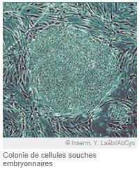 Médecine RÉGÉNÉRATIVE: Rajeunir nos cellules, réhabiliter certains organes – Genes & Développement Médecine RÉGÉNÉRATIVE: Rajeunir nos cellules, réhabiliter certains organes – Genes & Développement