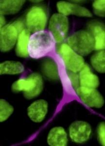 CANCERS: Le test qui prédit l’efficacité de la chimiothérapie – Science CANCERS: Le test qui prédit l’efficacité de la chimiothérapie – Science