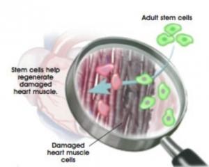 Les CELLULES SOUCHES cardiaques, une évidence pour la réparation cardiaque ? – The Lancet