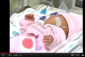 PRÉMATURITÉ: Melinda, le second plus petit bébé du monde rentre à la maison… – Grande prématurité