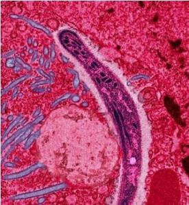 PALUDISME: DÉCOUVERTE capitale d’une protéine qui bloque la survie du parasite  – Journal of Biological Chemistry
