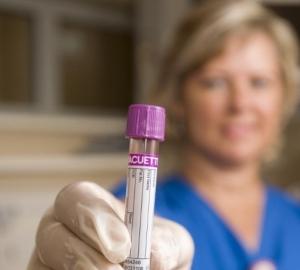 VHC: Bons résultats de phase I d’un candidat vaccin contre l’HÉPATITE C  –  Science Translational Medicine