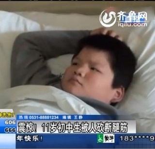 poignardé par sa mère knifesoninternet Poignardé par sa mère car il était accro aux jeux vidéo en ligne