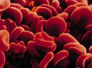 globules_rouges Comprendre les résultats des globules rouges dans une prise de sang.