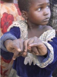 POLIO: Vaccination de case en case de 111 millions d’enfants africains – Unicef