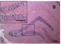 TOXOPLASMOSE vs ALZHEIMER: Toxoplasma gondii protège nos neurones  – PLoS ONE