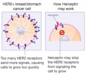 CANCER du SEIN: Une injection de 5 mn d’Herceptin aussi efficace qu’une chimio – 8e Conférence européenne sur le cancer du sein (EBCC-8)