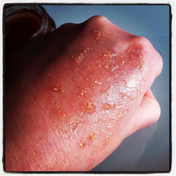 Belle à croquer Granité de Framboise Vue des petits grains - Belle à croquer Granité de Framboise