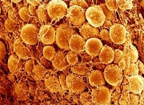 OBÉSITÉ: Transformer les adipocytes blancs en adipocytes bruns pour brûler les graisses – Nature Medicine