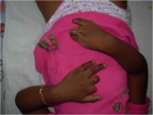 Image6 Elan de solidarité en faveur de 2 enfants malgaches