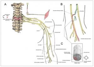 PARALYSIE: Un transfert nerveux redonne à un tétraplégique l’usage de ses mains – Journal of Neurosurgery