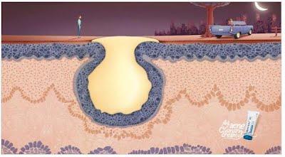 LA PUB QUI M'A PRESQUE FAIT VERSER UNE LARME... LA PUB QUI M'A PRESQUE FAIT VERSER UNE LARME...