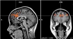 NEURO: Self-control, pourquoi notre cerveau ne gère pas toujours – Journal of Consumer Psychology