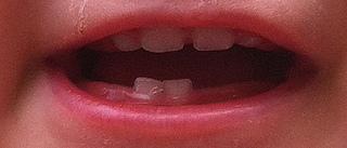 Dents de bébé
