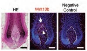 CALVITIE: Une super-vitamine qui booste les cellules souches des cheveux – Stem Cells Transational Medicine CALVITIE: Une super-vitamine qui booste les cellules souches des cheveux – Stem Cells Transational Medicine