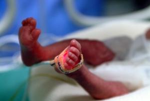 COMMUNICATION Patient: Mais mon bébé n’est pas si malade? – Journal of Perinatology