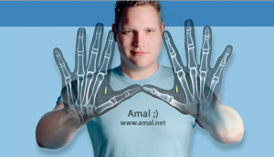 Amal et ses 2 implants