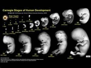 Une Australienne, mère de 12 enfants, accouche de quintuplés seize.jpg