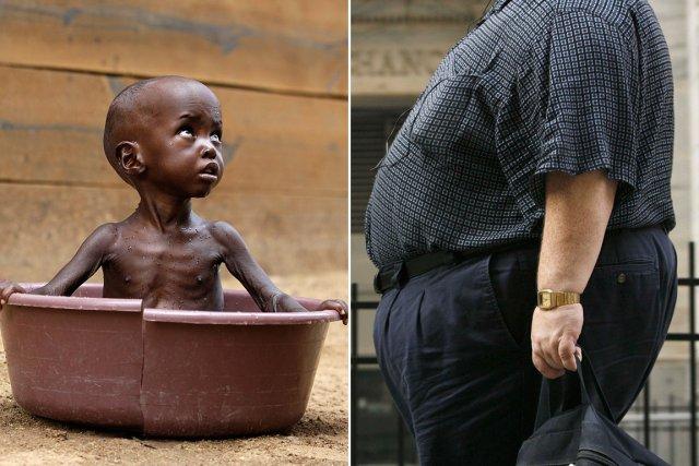 Un milliard d'humains meurent de faim. Un autre milliard est en surpoids, en... (Photo: archives AP et Reuters)