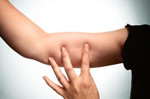 La contraception implantée La contraception implantée