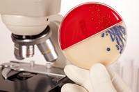 escherichia coli escherichia coli