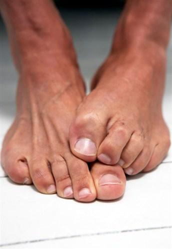 15 choses que vos pieds révèlent sur votre santé