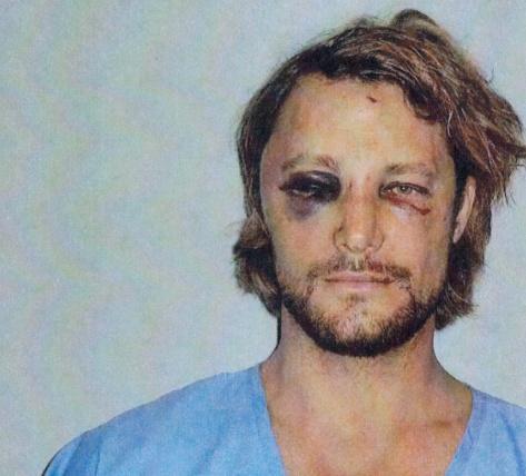 Choc: Gabriel Aubry défiguré par Olivier Martinez