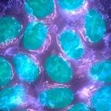 CANCER de la PROSTATE: Un virus caché dans un macrophage pour tuer la tumeur  – Cancer Research