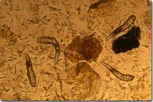Le parasite dans le caviar du saumon