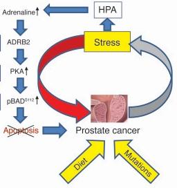 CANCER de la PROSTATE: Le stress réduit l’efficacité des traitements – Journal of Clinical Investigation
