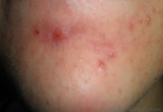 Je confie mes imperfections à un spécialiste ! Je confie mes imperfections à un spécialiste !