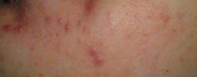 Je confie mes imperfections à un spécialiste ! Je confie mes imperfections à un spécialiste !